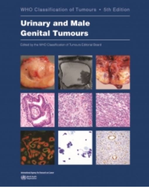 New WHO Classification for Urinary and Male Genital Tumours - ICCR