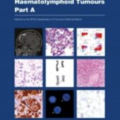 New WHO Classification for Haematolymphoid Tumours